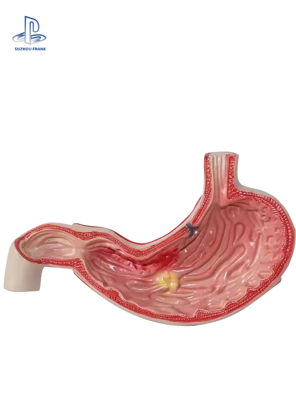 Suzhou Fank Gastrointestinal Anastomosis Model Gastroenterology Silicone  sSimulating the Texture Surgery Training Model