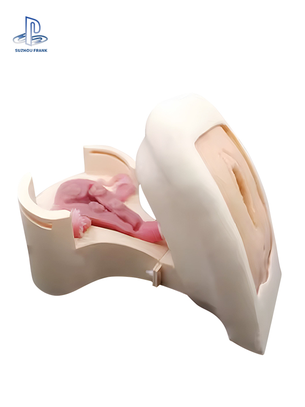 Suzhou Frank  Hysteroscopy  Training Model Endoscope Silicone 3D Printing Endoscopic Surgery Training Model
