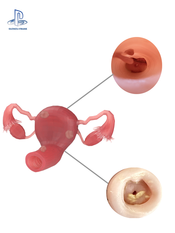 Suzhou Frank  Hysteroscopy  Training Model Endoscope Silicone 3D Printing Endoscopic Surgery Training Model
