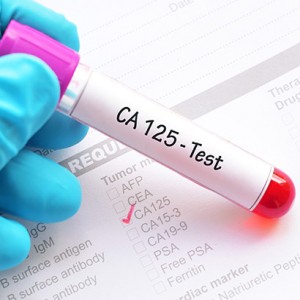 CA 125