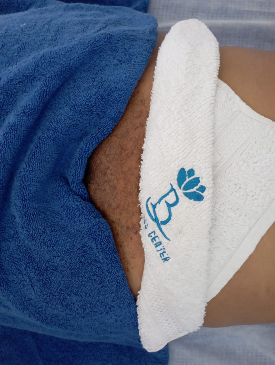 Mini Vagacial - Quick Intimate Area Treatment | 30 Mins