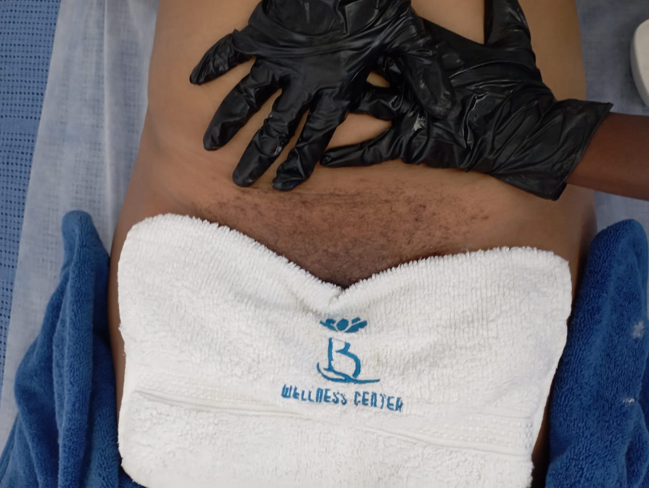 Full Vagacial - Complete Intimate Area Treatment 