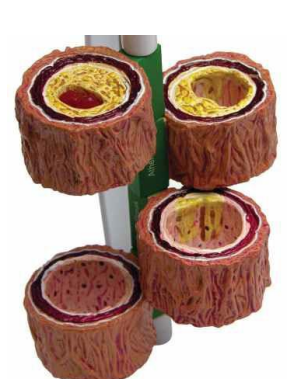 4 PIECE Artrey Modal