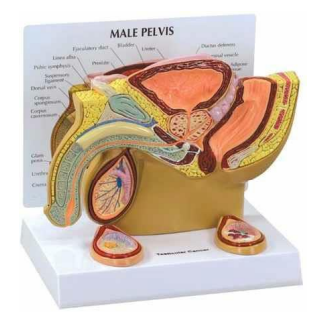 MALE PELVIS Staging of Testis Tumors