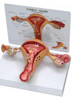 UTERUS - OVARY