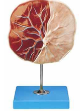 Fetal & Maternal  Surface Placenta