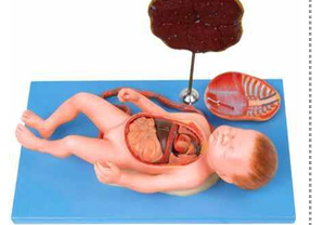 Fetus with Viscus  and Placenta