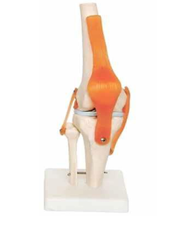 Functional Elbow Joint 