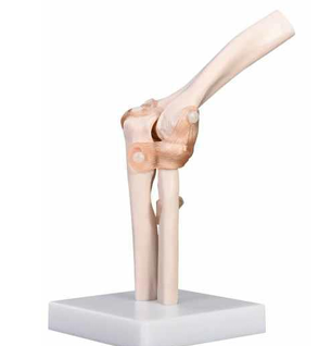Functional Elbow Joint 