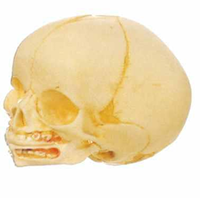 Infant Skull