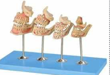 DEVELOPMENT OF  A SET OF TEETH 