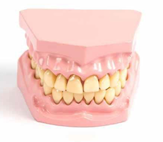 DENTAL MODEL SMALL