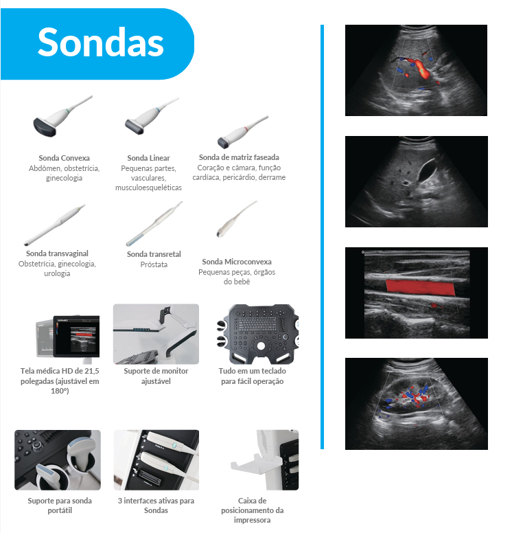  Ultrassom com Doppler totalmente digital  AMA DW-F3 