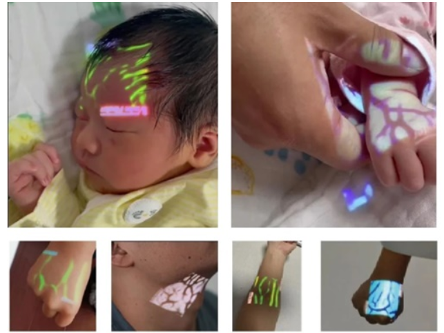 Venoscópio - Localizador de Veias AMA-QV-600  ( HUM.& VET. ) 