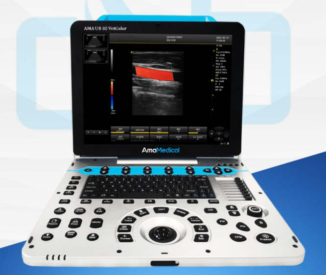 Ultrassom Portátil US30 Doppler Colorido DWP30