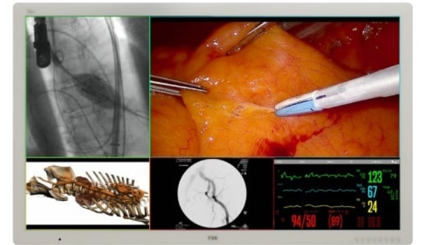 Monitor UHD de 58 "4K · D5801DV