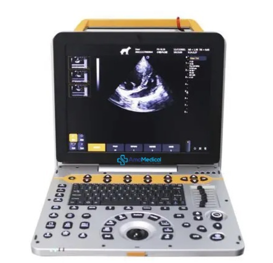 Ultrassom Portátil US60 TURBO Doppler Colorido