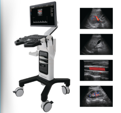 Ultrassom com Doppler totalmente digital  AMA DW-F3 