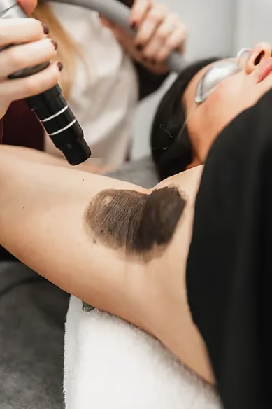 Holywood Peel Zona Corporal 
