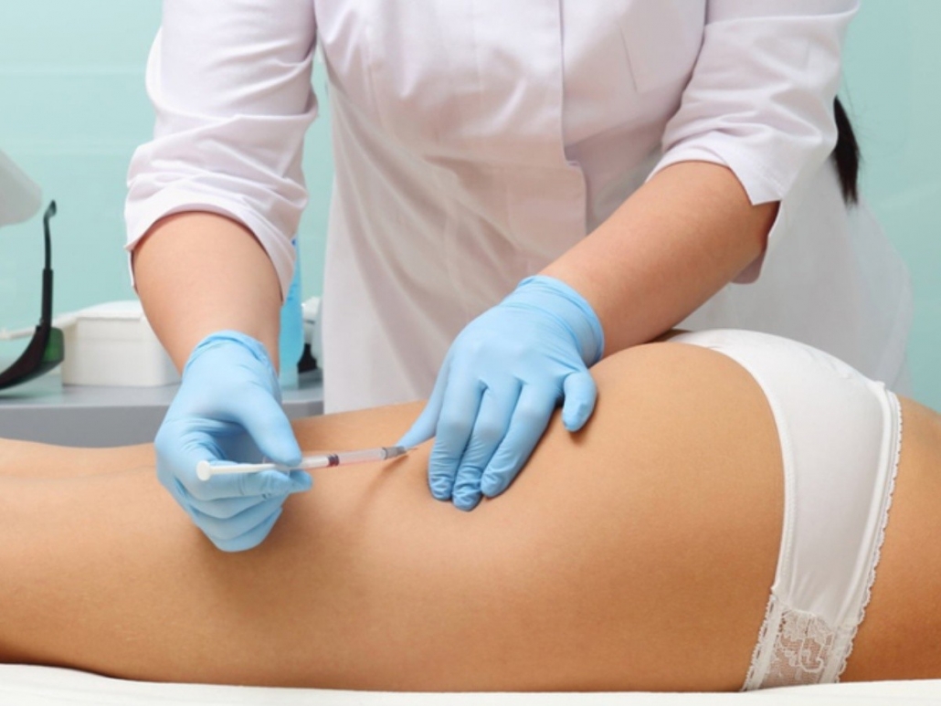 Carboxiterapia Celulitis 