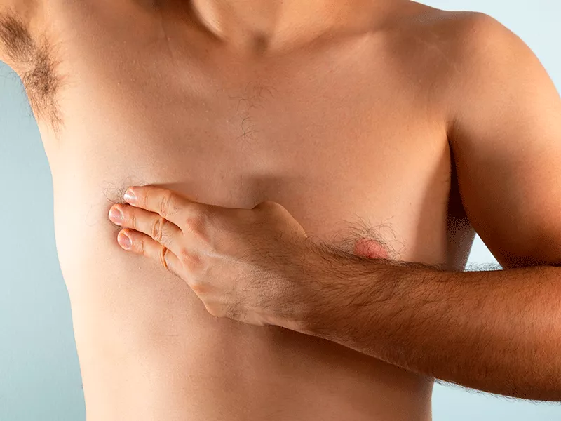 Hifu Pectorales 