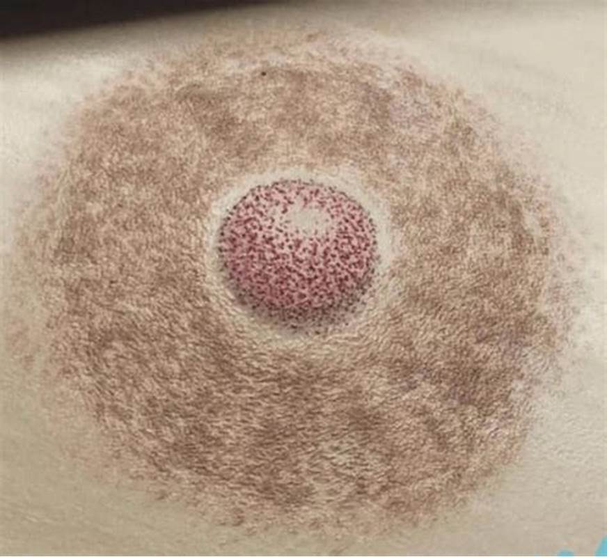 Micropigmentación Areolas