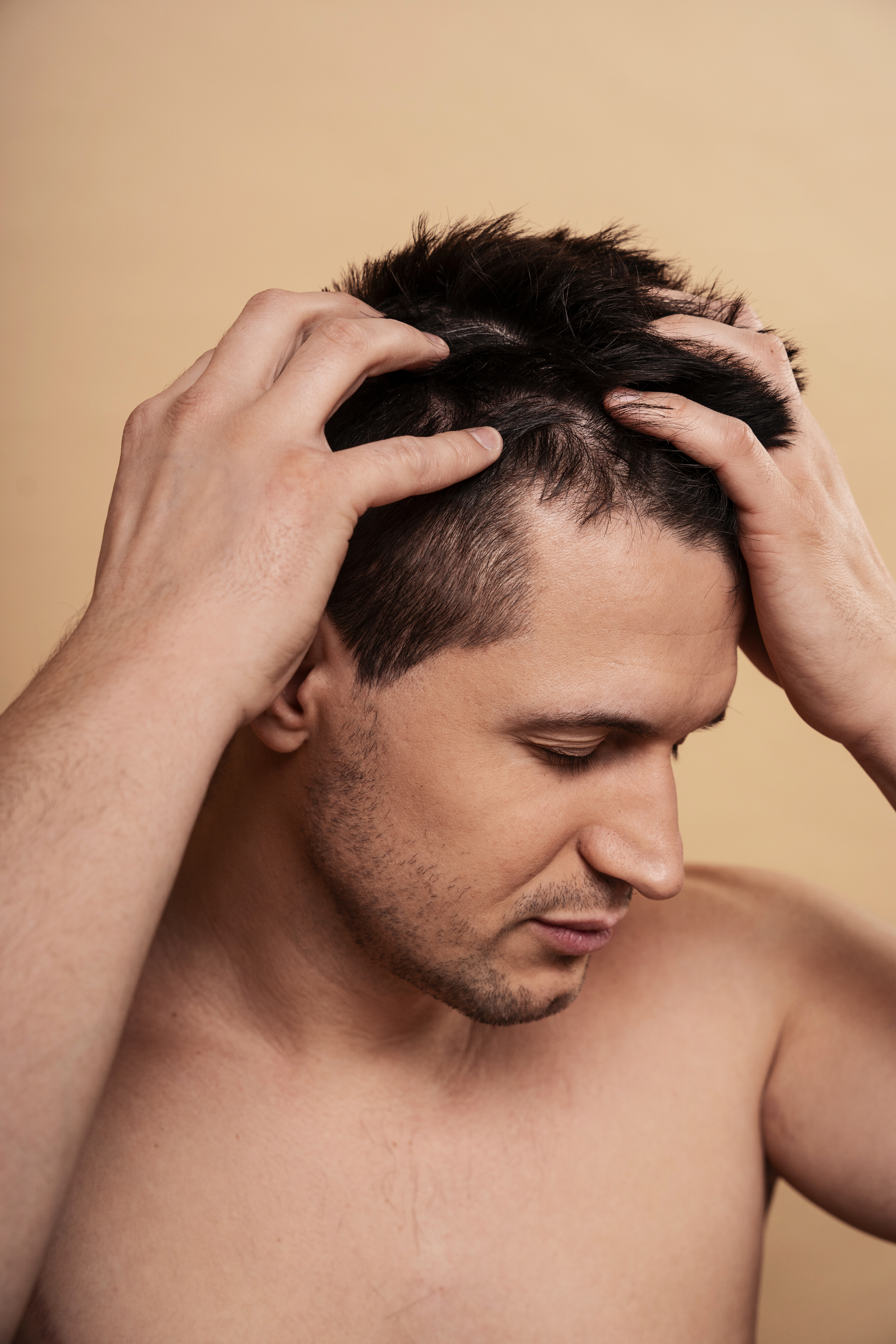 Tratamiento Alopecia Stress