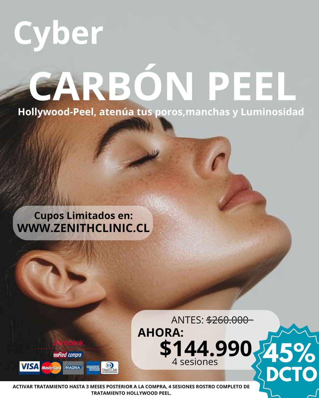 Cyber Carbon Peel