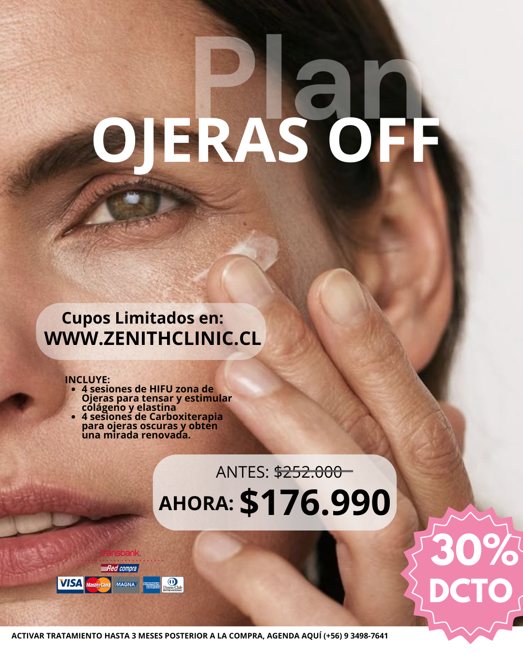 Plan Ojeras 