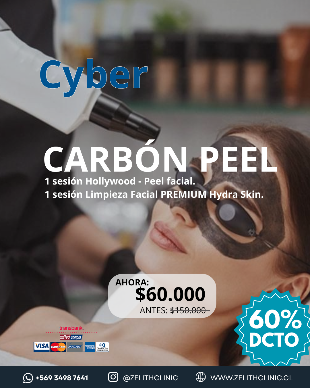 Carbón Peel Cyber 