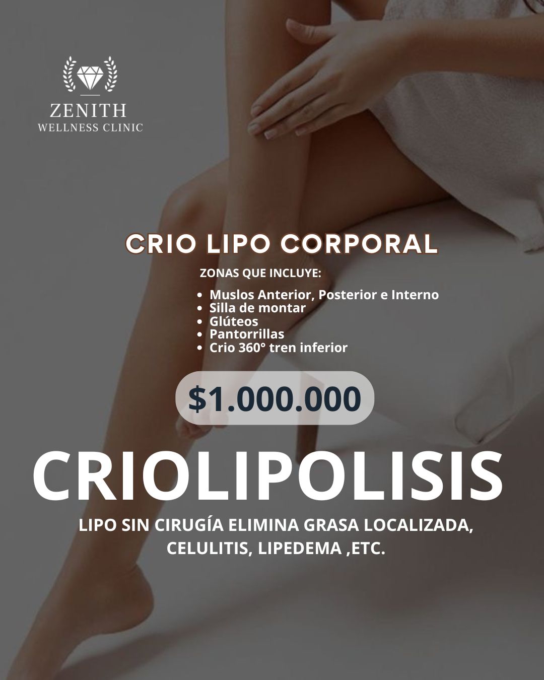 Crio Lipo Corporal 