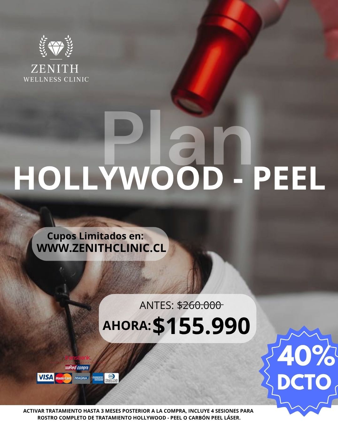 Plan Hollywood Peel