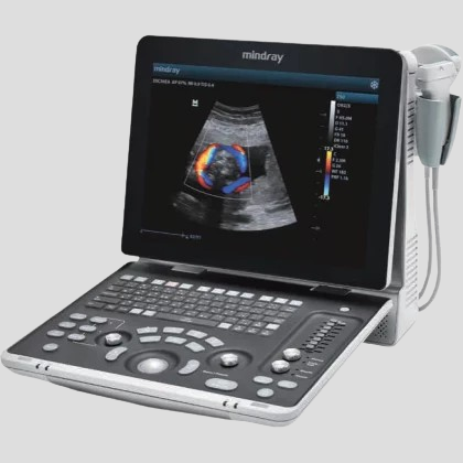 Système d'échographie diagnostique Mindray Z50 avec Doppler couleur