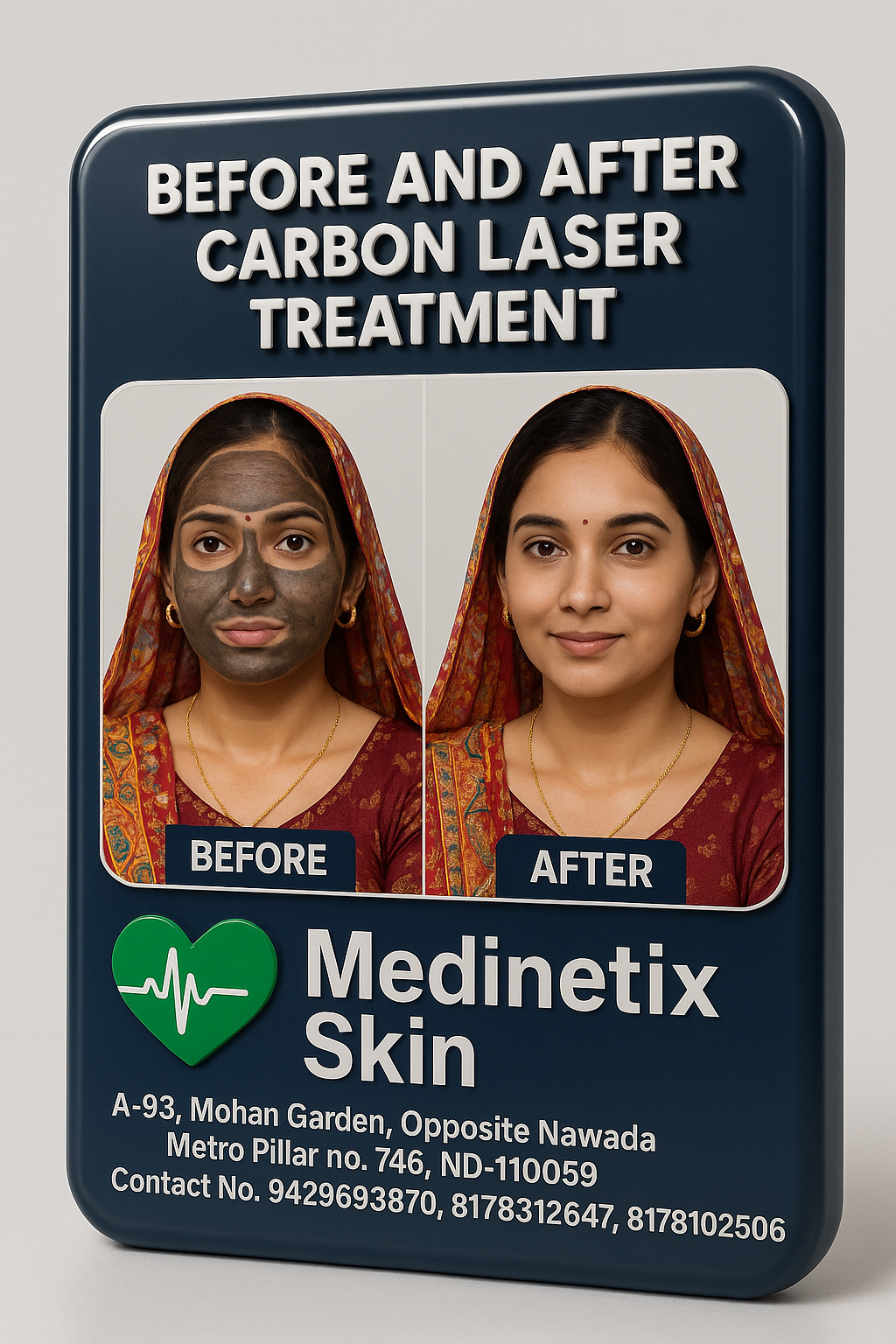 Carbon Laser Treatment