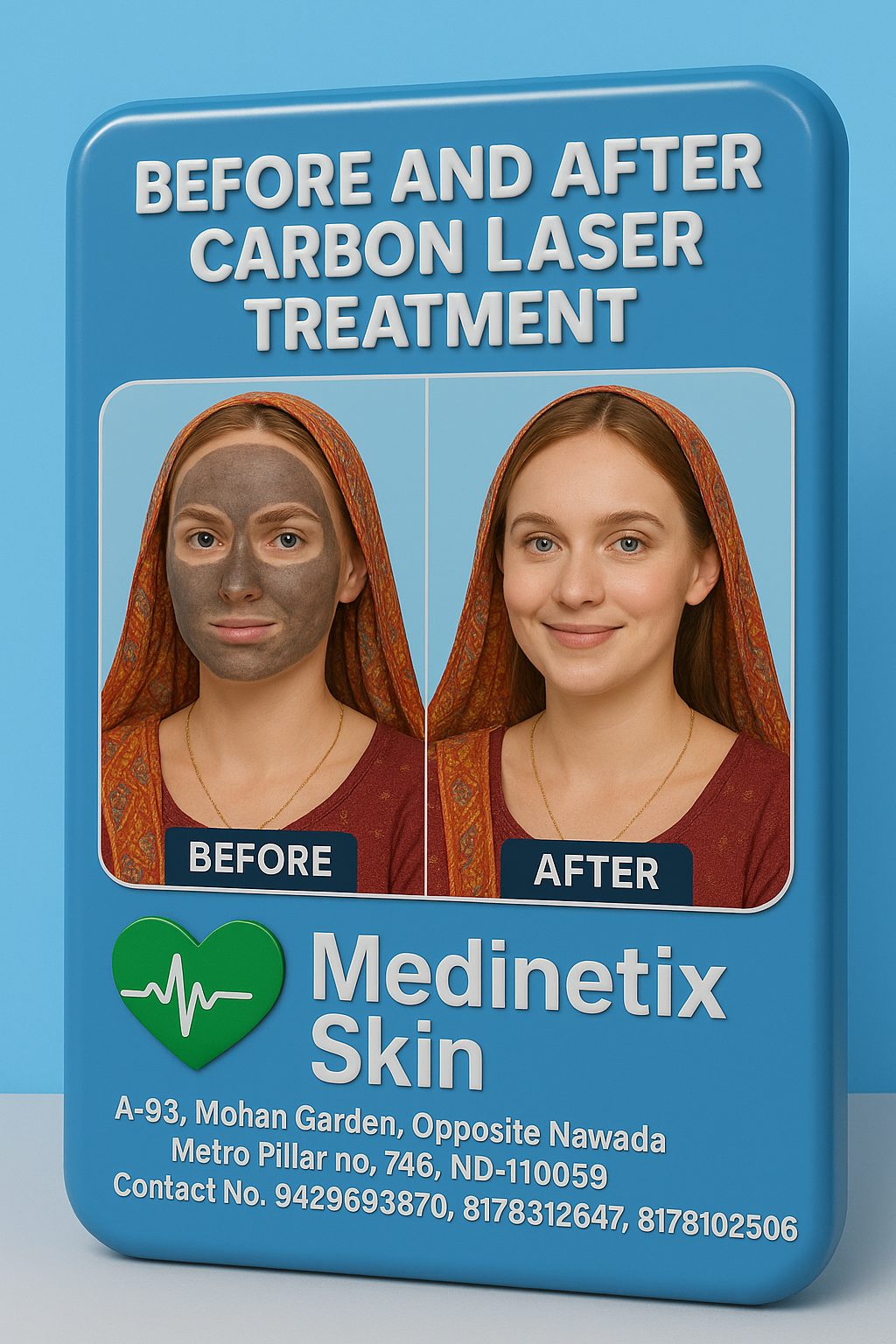 Carbon Laser treatment before and after