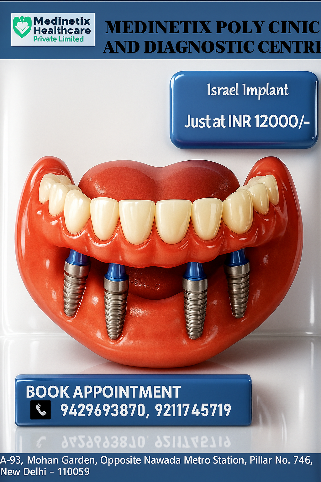 Dental Implants