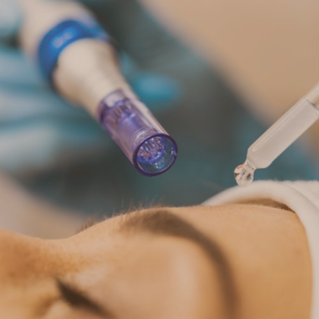 Dermapen con ampolleta 