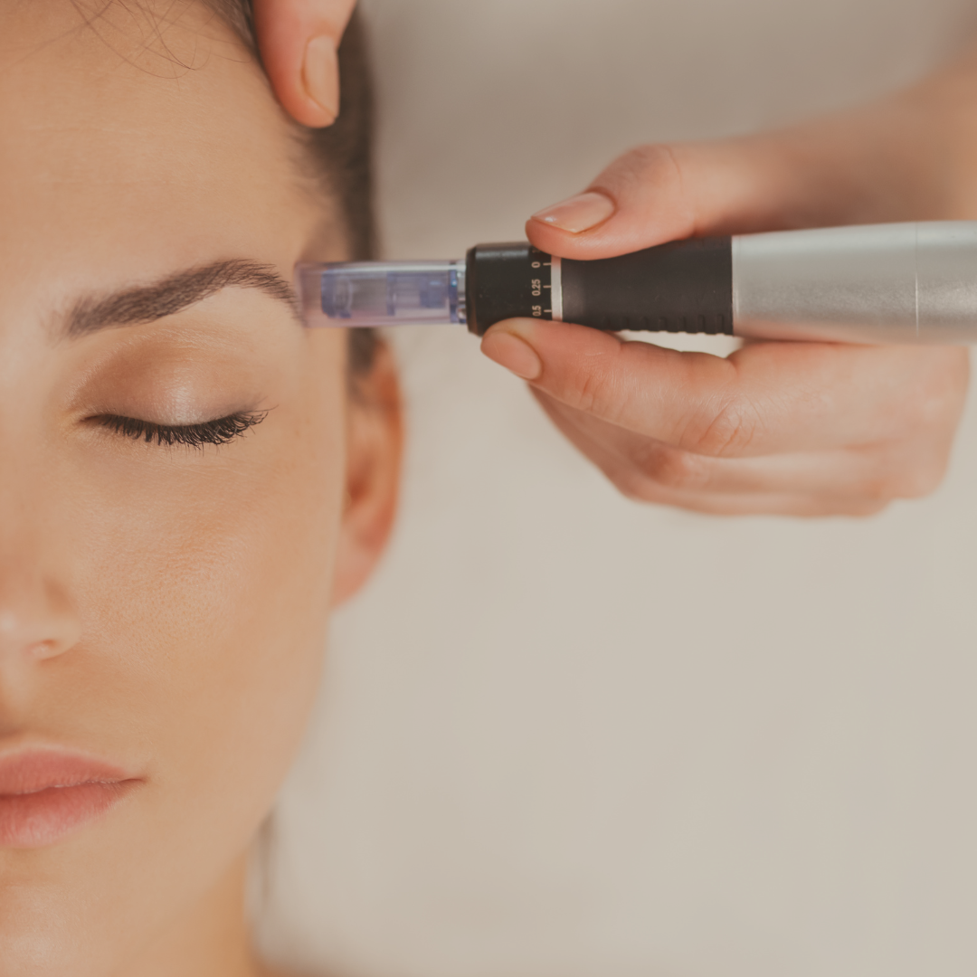 Dermapen NCTF TX de ojera