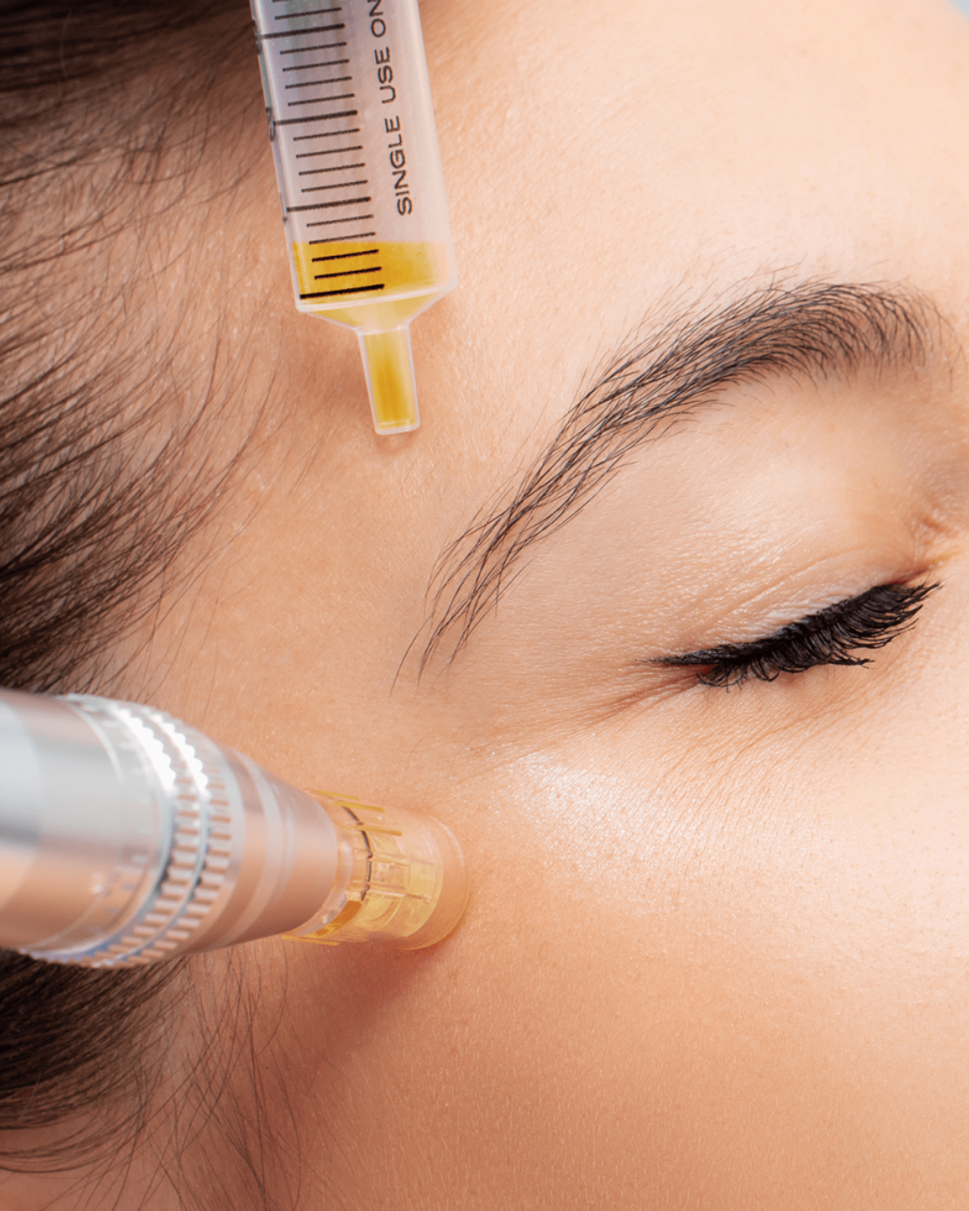 Dermapen Esperma de salmón (PDRN)  Remedium