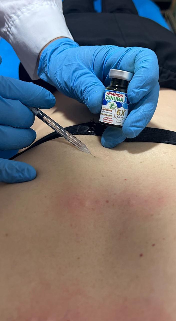 Apitherapy and Acupuncture / Apiterapia y Acupuntura
