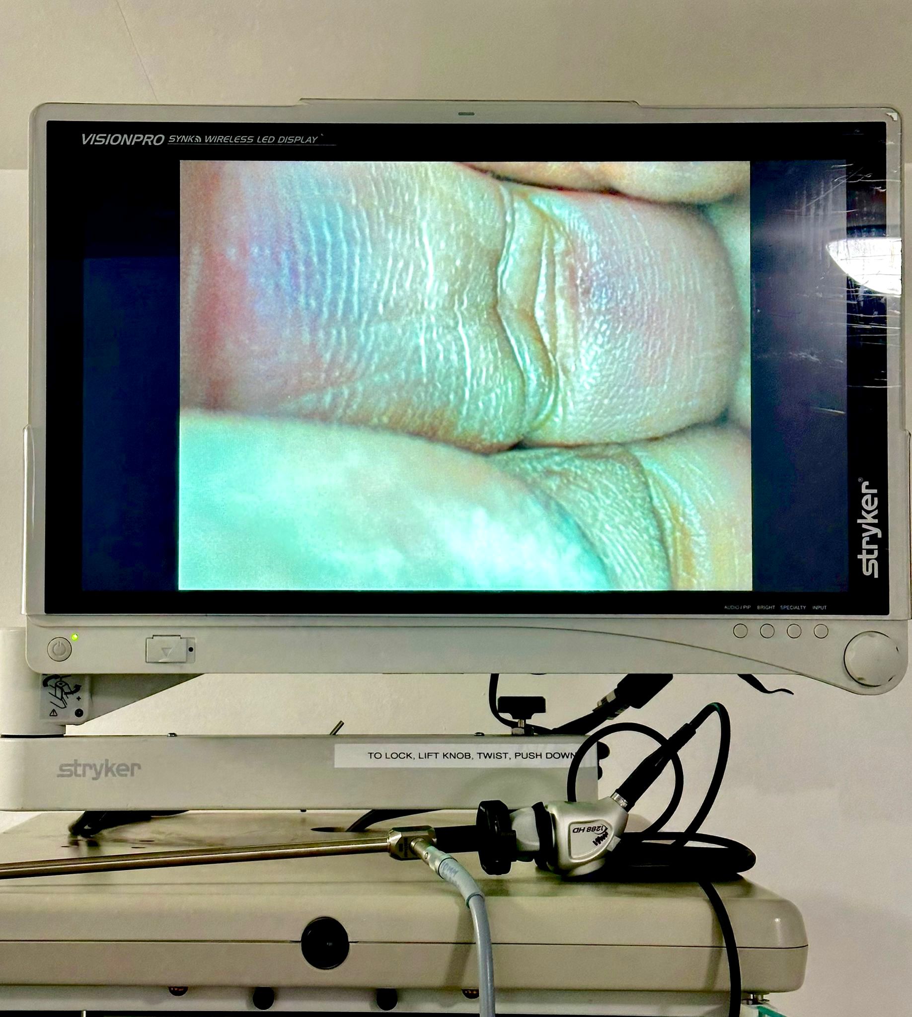 STRYKER 1288 HD Video Endoscopy Tower System