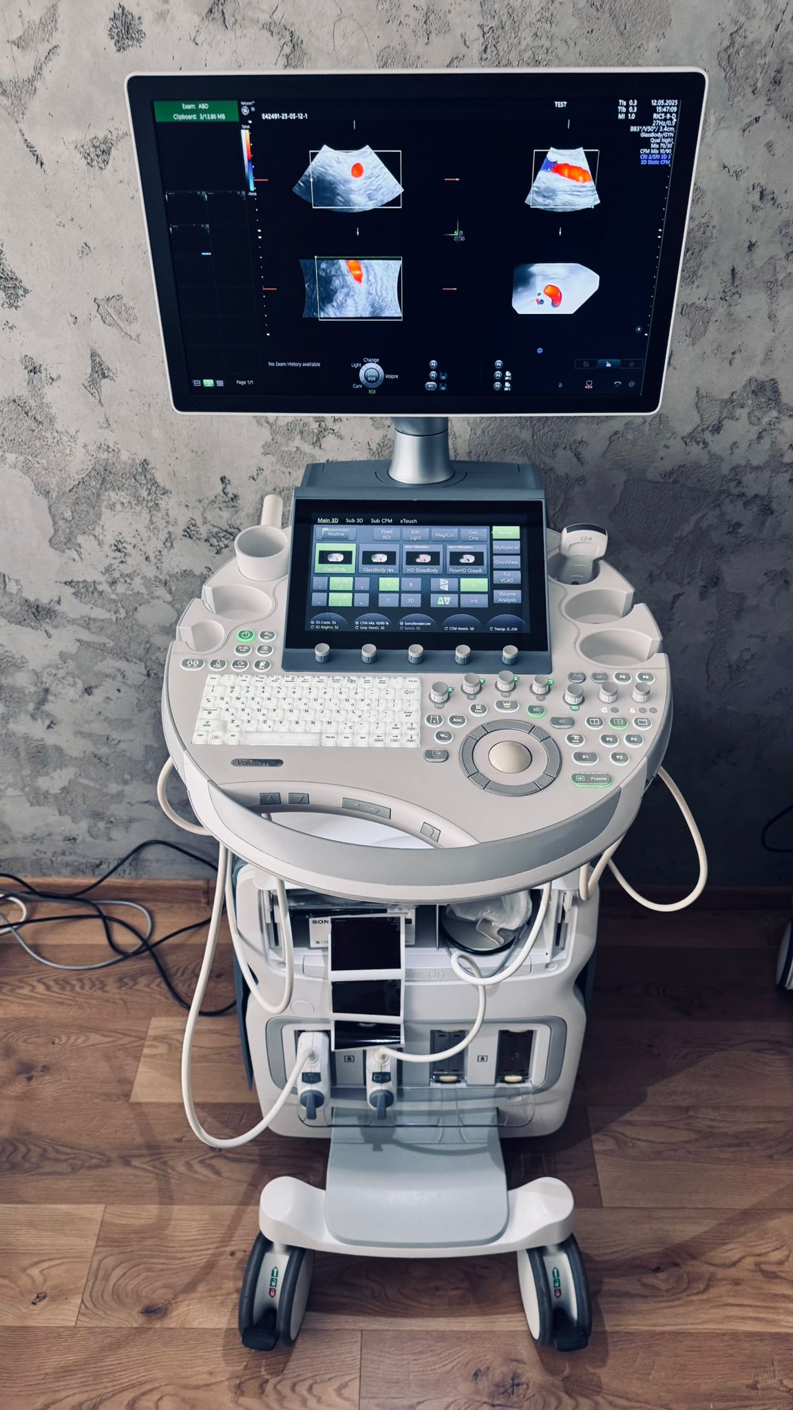 USG  GE Healthcare Voluson E8