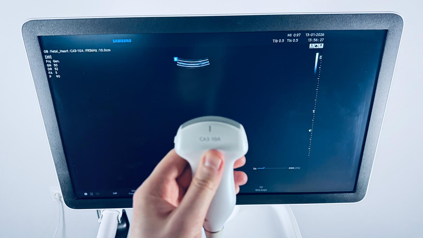 Aparat USG Samsung Hera W10