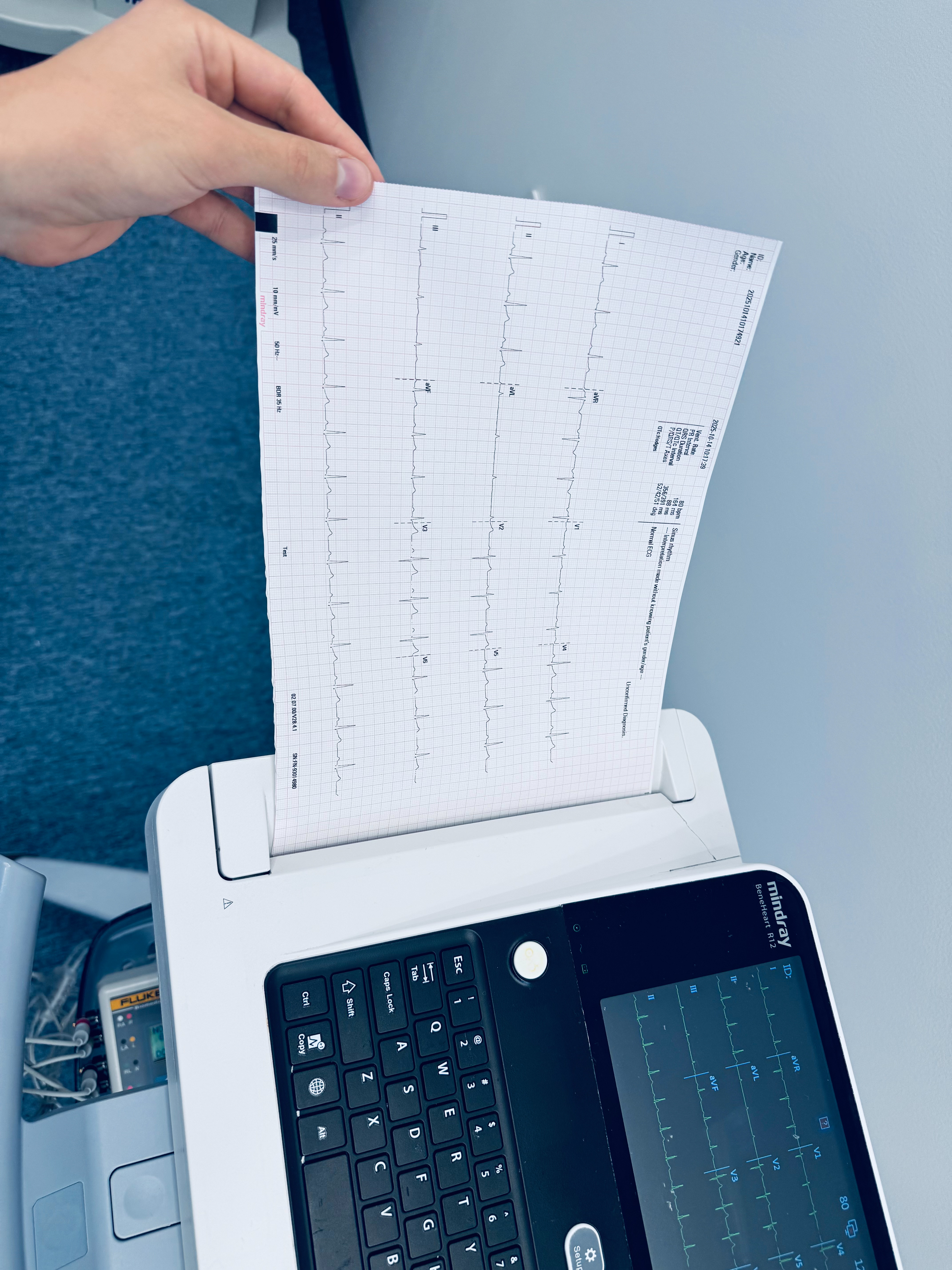 Aparat EKG Mindray Beneheart R12