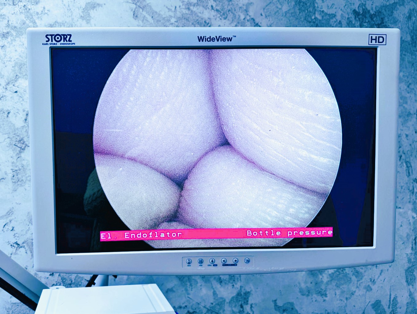 Tor Wizyjny  Karl Storz Image 1 Hub