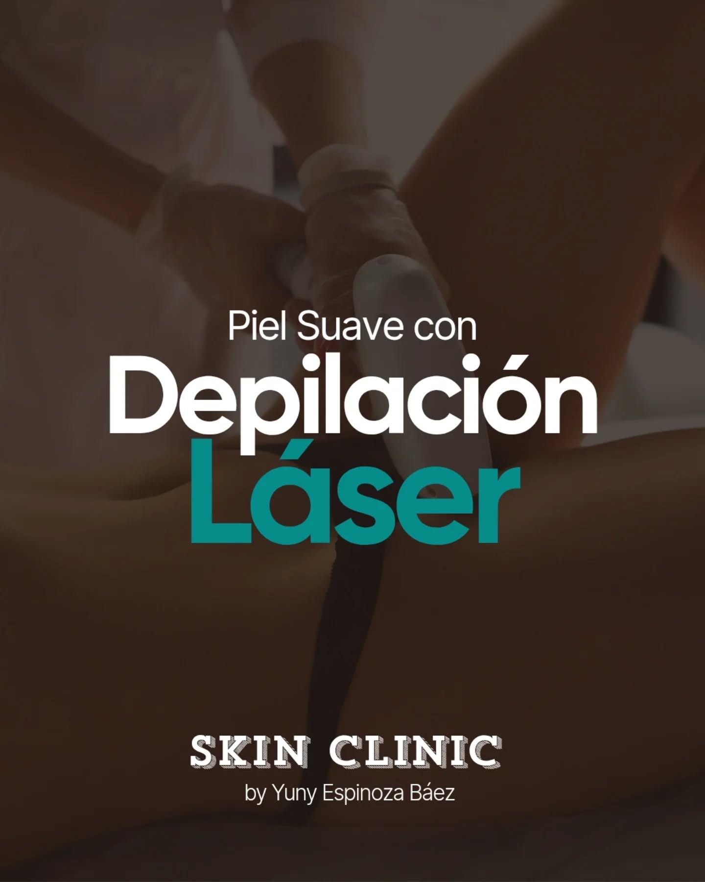 DEPILACION LASER