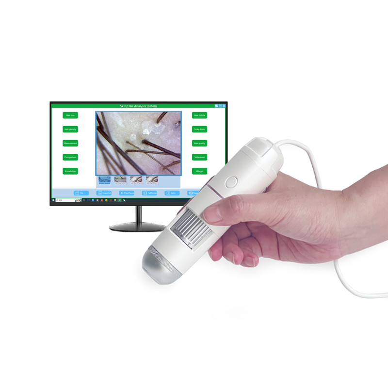 Professional USB Hair & Scalp Analysis Machine
