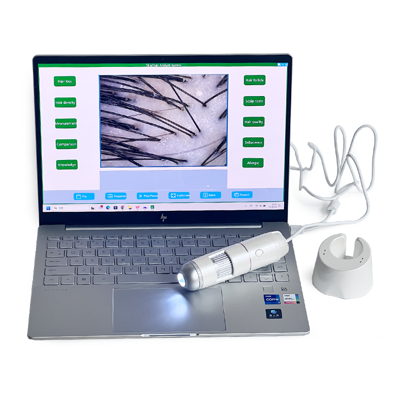 Professional USB Hair & Scalp Analysis Machine