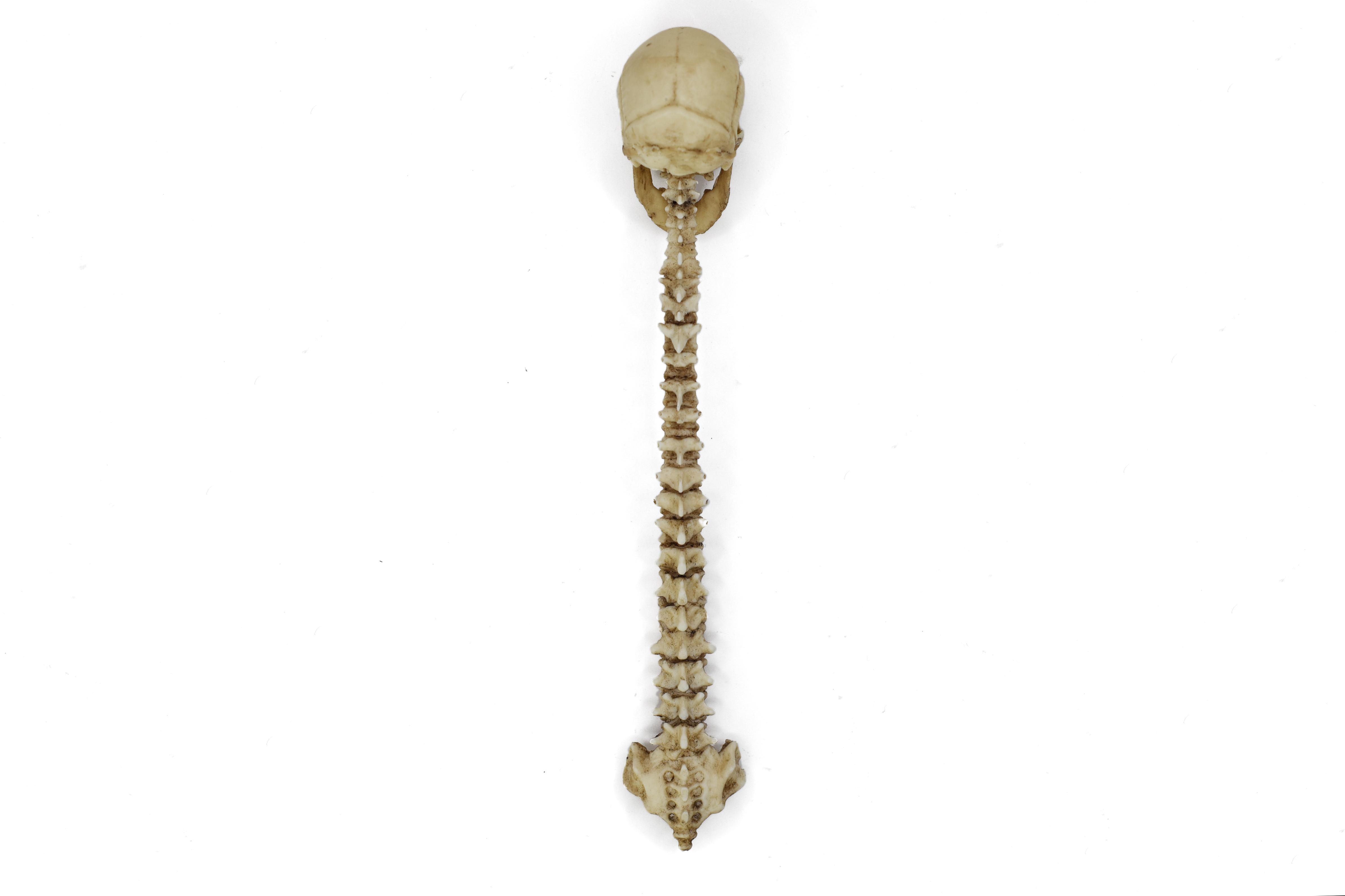 Human Spine and Skull 1/6 Scale