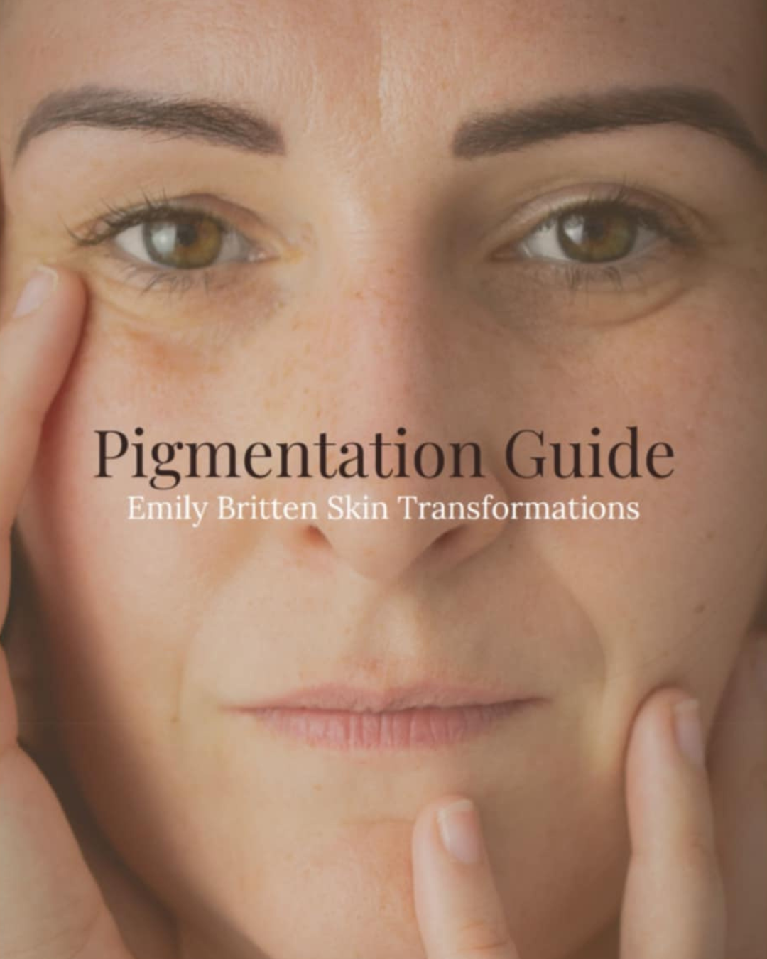 Pigmentation Guide